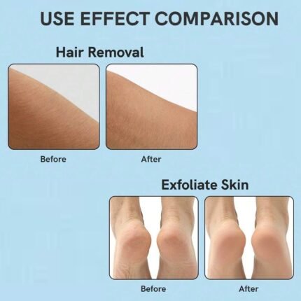 Multipurpose Hair Removal Pad For Legs, Arms Back (1 Pc)